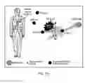 Fig. 13 - Short-range wireless networks