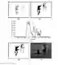 Fig. 01 - System and method for motion detection and the use thereof in video coding