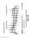 Fig. 44 - METHODS AND SYSTEMS FOR PRODUCING AN IMPLANT