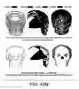 Fig. 46 - METHODS AND SYSTEMS FOR PRODUCING AN IMPLANT