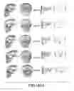 Fig. 49 - METHODS AND SYSTEMS FOR PRODUCING AN IMPLANT