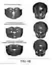 Fig. 52 - METHODS AND SYSTEMS FOR PRODUCING AN IMPLANT