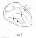 Fig. 06 - Medical image processing apparatus and medical image processing method