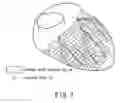 Fig. 08 - Medical image processing apparatus and medical image processing method