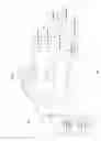 Fig. 02 - Method of removing foil shadows of a synchronous grid, and a radiographic apparatus using the same