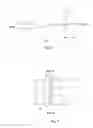 Fig. 06 - Method of removing foil shadows of a synchronous grid, and a radiographic apparatus using the same