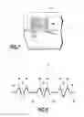 Fig. 08 - Indexable Drill and Drill Body