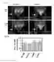 Fig. 04 - Methods of leukemia cell detection