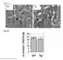 Fig. 06 - Methods of leukemia cell detection