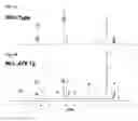 Fig. 09 - Methods of leukemia cell detection