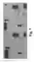 Fig. 04 - METHODS OF TREATING NERVOUS SYSTEM CONDITIONS