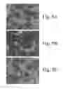 Fig. 06 - METHODS OF TREATING NERVOUS SYSTEM CONDITIONS