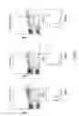 Fig. 06 - Cells, nucleic acid constructs, cells comprising said constructs and methods utilizing said cells in the treatment of diseases