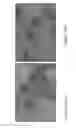 Fig. 17 - Vaccine immunotherapy