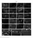 Fig. 03 - Efficient Generation of Neurally-Induced Mesenchymal Stem Cells and Applications Thereof
