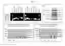 Fig. 04 - Efficient Generation of Neurally-Induced Mesenchymal Stem Cells and Applications Thereof