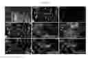 Fig. 08 - Efficient Generation of Neurally-Induced Mesenchymal Stem Cells and Applications Thereof