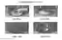 Fig. 01 - Tissue engineered meniscus scaffolds and methods of use