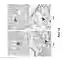 Fig. 03 - METHODS OF TREATING EDEMA RELATED TO ISCHEMIA-REPERFUSION