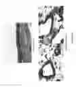 Fig. 47 - Tissue Engineering of Lung