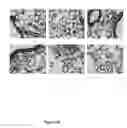Fig. 65 - Tissue Engineering of Lung
