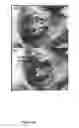 Fig. 71 - Tissue Engineering of Lung