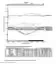 Fig. 03 - Compositions and Methods for Preventing Erythropoietin-Associated Hypertension