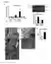 Fig. 02 - DYSFUNCTION OF THE MITOCHONDRIAL RESPIRATORY CHAIN, METHODS FOR DIAGNOSIS, TREATMENT AND FOLLOW-UP
