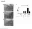 Fig. 05 - DYSFUNCTION OF THE MITOCHONDRIAL RESPIRATORY CHAIN, METHODS FOR DIAGNOSIS, TREATMENT AND FOLLOW-UP