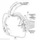 Fig. 01 - Intracoronary Device And Method Of Use Thereof