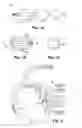 Fig. 02 - Intracoronary Device And Method Of Use Thereof