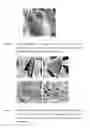 Fig. 11 - POLYMERIC PHARMACEUTICAL DOSAGE FORM IN SUSTAINED RELEASE