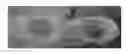 Fig. 01 - METHOD OF TREATING ECZEMA