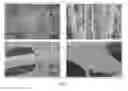 Fig. 06 - WOUND DRESSING