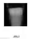 Fig. 02 - Gallium-Doped Phosphocalcic Compounds