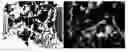 Fig. 01 - Bone filling material comprising sintered titanium dioxide and dextrin and method for reconstructing bone defects using the same