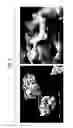 Fig. 04 - Bone filling material comprising sintered titanium dioxide and dextrin and method for reconstructing bone defects using the same