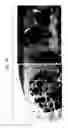 Fig. 07 - Bone filling material comprising sintered titanium dioxide and dextrin and method for reconstructing bone defects using the same