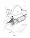Fig. 02 - Avocado Cutting and Splitting Device