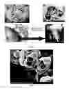 Fig. 07 - PREPARATION OF NANOSTRUCTURED MICROPOROUS COMPOSITE FOAMS