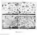 Fig. 14 - PREPARATION OF NANOSTRUCTURED MICROPOROUS COMPOSITE FOAMS