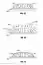 Fig. 02 - Hydrogel implants with varying degrees of crosslinking