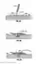 Fig. 07 - Hydrogel implants with varying degrees of crosslinking