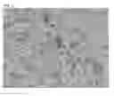 Fig. 08 - TOOTH SURFACE REPAIRING MATERIAL