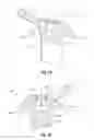 Fig. 09 - Methods of Manufacturing a Convertible Orthodontic Bracket by Machining