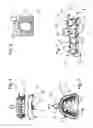 Fig. 03 - IMPRESSION TRAY, AND METHOD FOR CAPTURING STRUCTURES, ARRANGEMENTS OR SHAPES, IN PARTICULAR IN THE MOUTH OR HUMAN BODY
