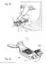 Fig. 10 - IMPRESSION TRAY, AND METHOD FOR CAPTURING STRUCTURES, ARRANGEMENTS OR SHAPES, IN PARTICULAR IN THE MOUTH OR HUMAN BODY