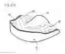 Fig. 11 - IMPRESSION TRAY, AND METHOD FOR CAPTURING STRUCTURES, ARRANGEMENTS OR SHAPES, IN PARTICULAR IN THE MOUTH OR HUMAN BODY