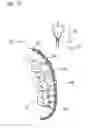 Fig. 15 - IMPRESSION TRAY, AND METHOD FOR CAPTURING STRUCTURES, ARRANGEMENTS OR SHAPES, IN PARTICULAR IN THE MOUTH OR HUMAN BODY