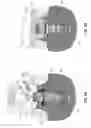Fig. 09 - Dental retention systems